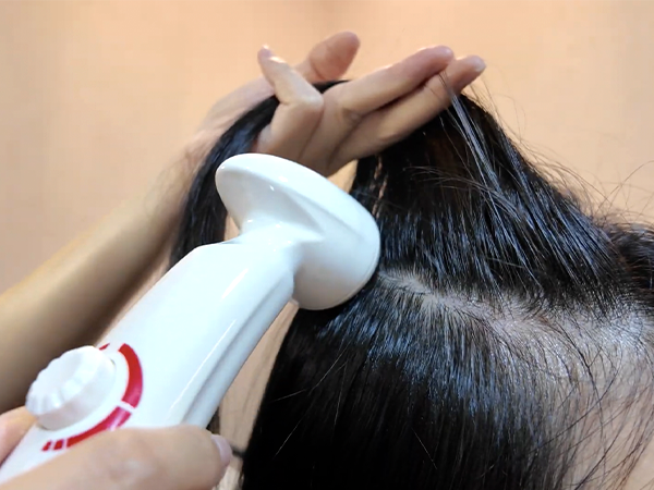 Scalp Repair image