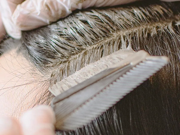 Scalp Balance image